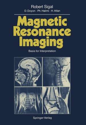 Magnetic Resonance Imaging: Basis for Interpretation de Robert Sigal