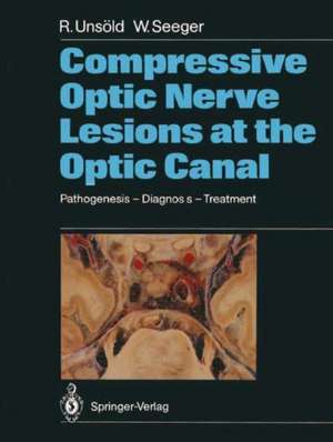 Compressive Optic Nerve Lesions at the Optic Canal: Pathogenesis – Diagnosis – Treatment de Michael Bach