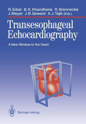 Transesophageal Echocardiography: A New Window to the Heart de Raimund Erbel