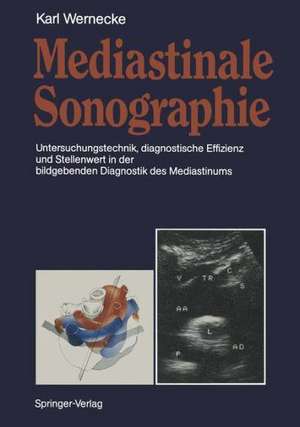 Mediastinale Sonographie: Untersuchungstechnik, diagnostische Effizienz und Stellenwert in der bildgebenden Diagnostik des Mediastinums de Karl Wernecke