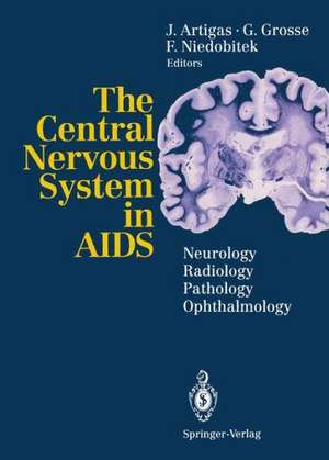 The Central Nervous System in AIDS: Neurology · Radiology · Pathology · Ophthalmology de Juan Artigas