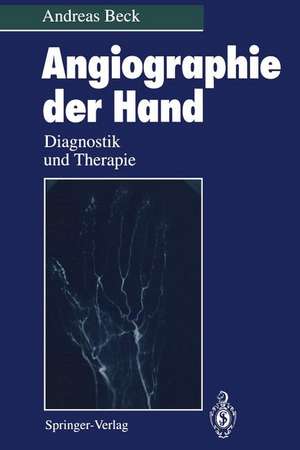 Angiographie der Hand: Diagnostik und Therapie de Andreas Beck