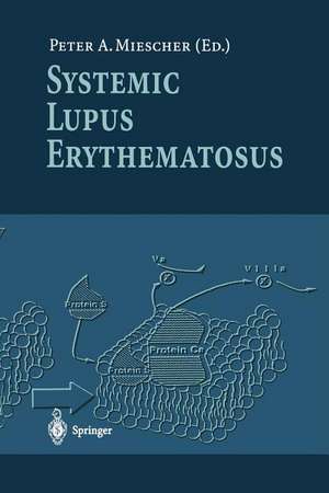 Systemic Lupus Erythematosus de Peter A. Miescher