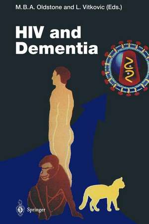 HIV and Dementia: Proceedings of the NIMH-Sponsored Conference “Pathogenesis of HIV Infection of the Brain: Impact on Function and Behavior” de Michael B.A. Oldstone