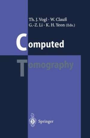 Computed Tomography: State of the Art and Future Applications de Thomas J. Vogl