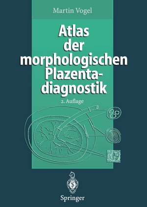 Atlas der morphologischen Plazentadiagnostik de Martin Vogel