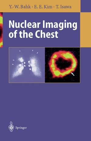 Nuclear Imaging of the Chest de Yong-Whee Bahk