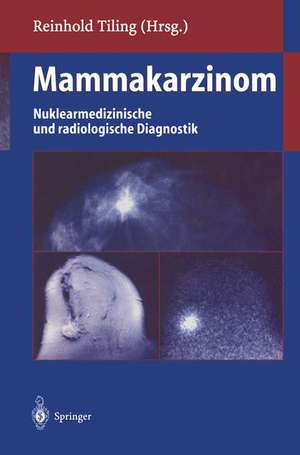 Mammakarzinom: Nuklearmedizinische und radiologische Diagnostik de Reinhold Tiling