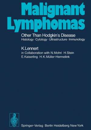 Malignant Lymphomas Other than Hodgkin’s Disease: Histology · Cytology · Ultrastructure · Immunology de Karl Lennert