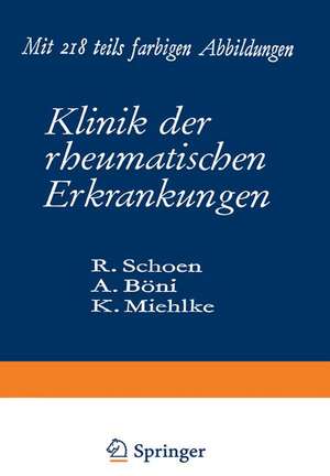 Klinik der rheumatischen Erkrankungen de Rudolf Schoen