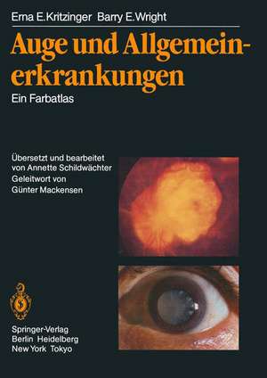 Auge und Allgemeinerkrankungen: Ein Farbatlas de Erna E. Kritzinger