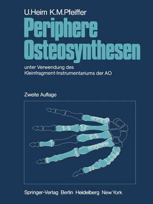 Periphere Osteosynthesen: unter Verwendung des Kleinfragment-Instrumentariums der AO de U. Heim