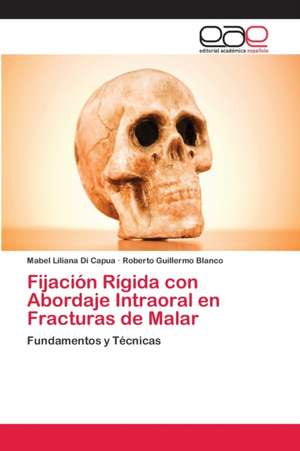 Fijacion Rigida Con Abordaje Intraoral En Fracturas de Malar