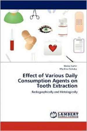 Effect of Various Daily Consumption Agents on Tooth Extraction de Walaa Samir