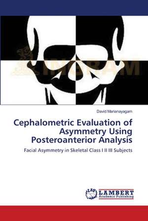 Cephalometric Evaluation of Asymmetry Using Posteroanterior Analysis de David Marianayagam