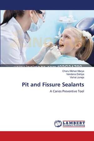 Pit and Fissure Sealants de Charu Mohan Marya