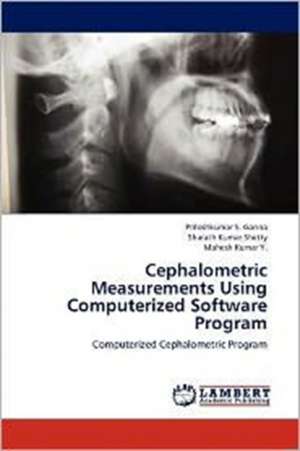 Cephalometric Measurements Using Computerized Software Program de Priteshkumar S. Ganna