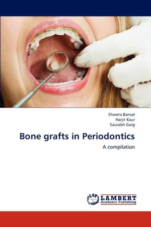 Bone grafts in Periodontics de Shweta Bansal