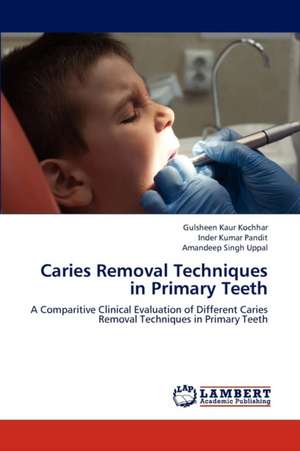 Caries Removal Techniques in Primary Teeth de Kochhar Gulsheen Kaur