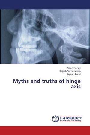 Myths and truths of hinge axis de Dubey Pavan