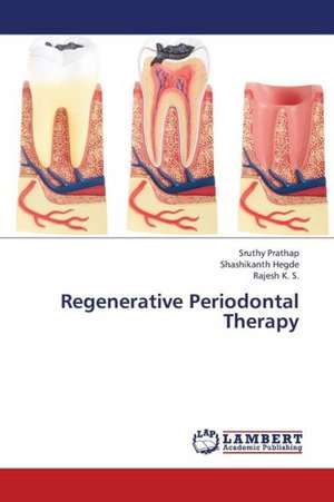 Regenerative Periodontal Therapy de Prathap Sruthy