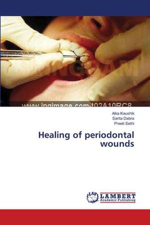 Healing of periodontal wounds de Kaushik Alka