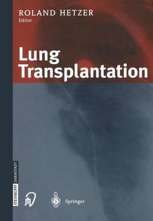 Lung Transplantation de R. Hetzer