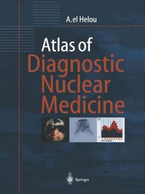 Atlas of Diagnostic Nuclear Medicine de Anisah el Helou