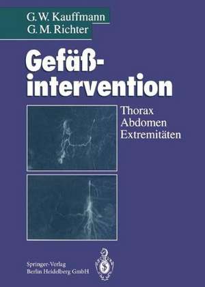 Gefäßintervention: Thorax, Abdomen, Extremitäten de G. W. Kauffmann