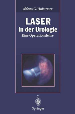 Laser in der Urologie: Eine Operationslehre de Alfons G. Hofstetter