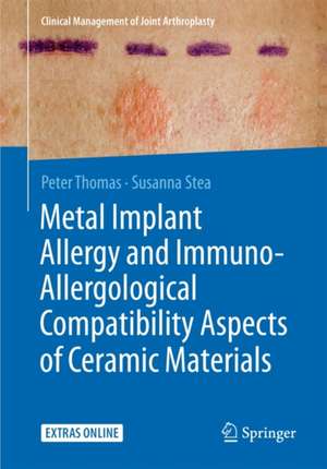 Metal Implant Allergy and Immuno-Allergological Compatibility Aspects of Ceramic Materials de Peter Thomas