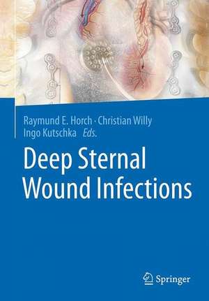 Deep Sternal Wound Infections de Raymund E. Horch