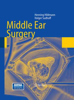 Middle Ear Surgery de Henning Hildmann