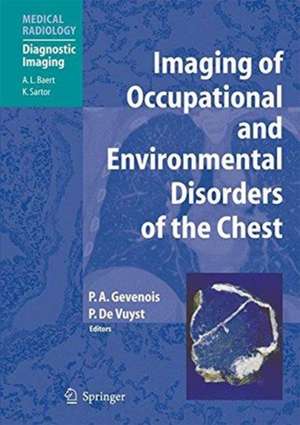 Imaging of Occupational and Environmental Disorders of the Chest de Pierre Alain Gevenois