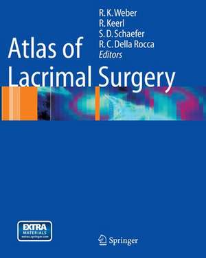 Atlas of Lacrimal Surgery de Rainer K. Weber