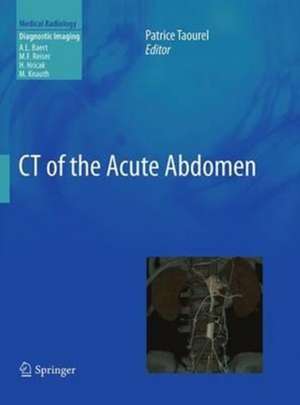 CT of the Acute Abdomen de Patrice Taourel