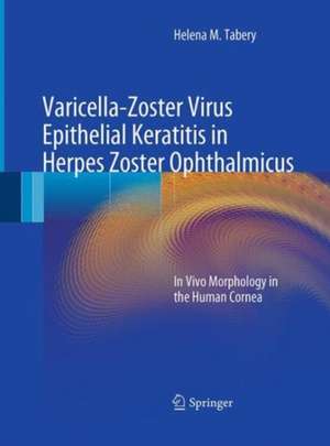 Varicella-Zoster Virus Epithelial Keratitis in Herpes Zoster Ophthalmicus: In Vivo Morphology in the Human Cornea de Helena M. Tabery