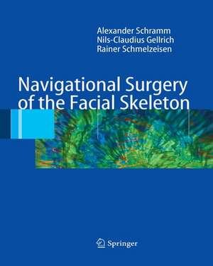 Navigational Surgery of the Facial Skeleton de Alexander Schramm