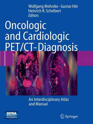 Oncologic and Cardiologic PET/CT-Diagnosis: An Interdisciplinary Atlas and Manual de Wolfgang Mohnike