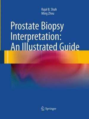 Prostate Biopsy Interpretation: An Illustrated Guide de Rajal B. Shah