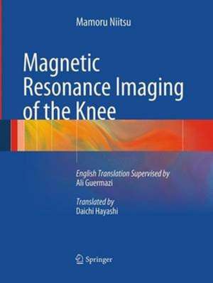 Magnetic Resonance Imaging of the Knee de Mamoru Niitsu