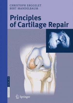 Principles of Cartilage Repair de Christoph Erggelet