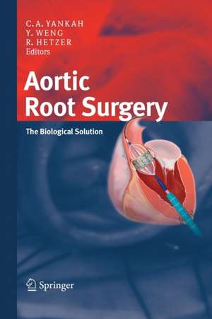 Aortic Root Surgery: The Biological Solution de Charles Abraham Yankah