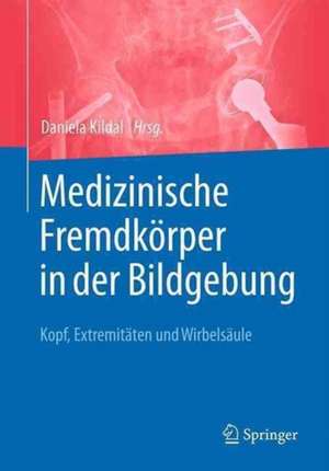 Medizinische Fremdkörper in der Bildgebung: Kopf, Extremitäten und Wirbelsäule de Daniela Kildal