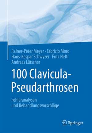 100 Clavicula-Pseudarthrosen: Fehleranalysen und Behandlungsvorschläge de Rainer-Peter Meyer