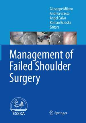 Management of Failed Shoulder Surgery de Giuseppe Milano