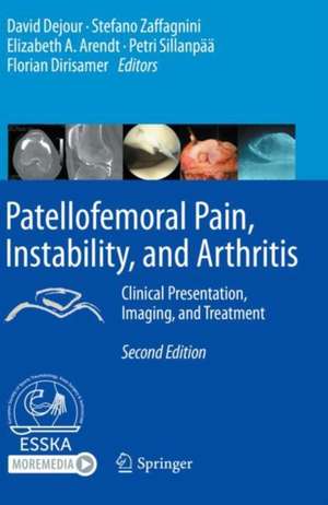 Patellofemoral Pain, Instability, and Arthritis: Clinical Presentation, Imaging, and Treatment de David Dejour