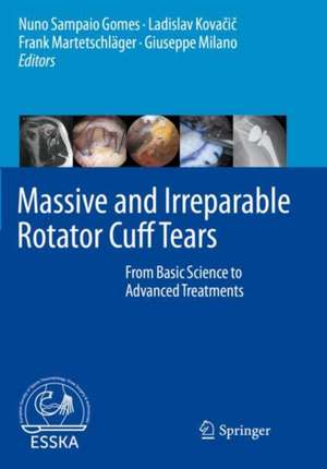 Massive and Irreparable Rotator Cuff Tears: From Basic Science to Advanced Treatments de Nuno Sampaio Gomes