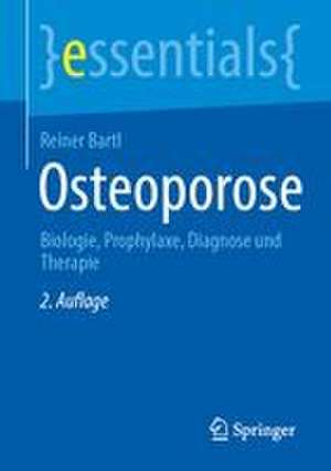Osteoporose de Reiner Bartl