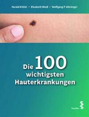 Die 100 wichtigsten Hauterkrankungen de Harald Kittler